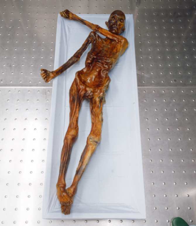 Ötzi