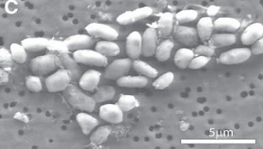 E' stato trovato un batterio in grado di sopravvivere a base di arsenico, in un ambiente finora considerato incompatibile con la vita. “ET” non vive su un altro pianeta, ma sulla Terra.